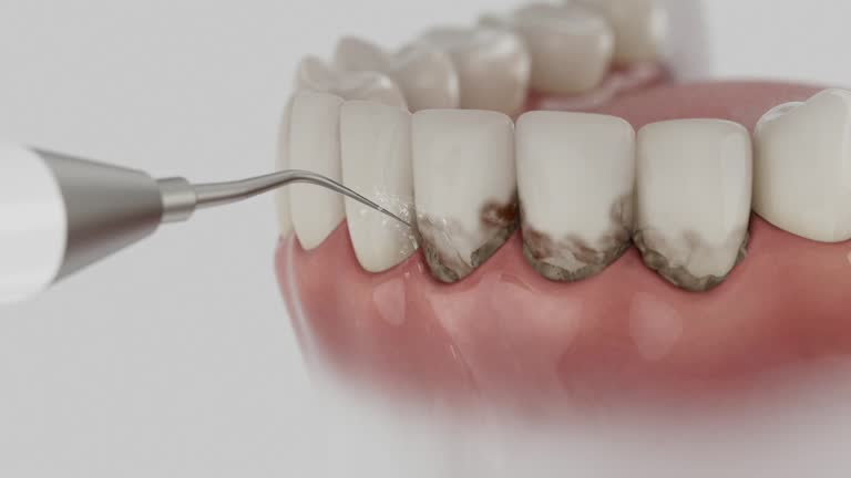 Trusted Root Canal Treatment service in Happy Valley, OR - Dentist Open Now